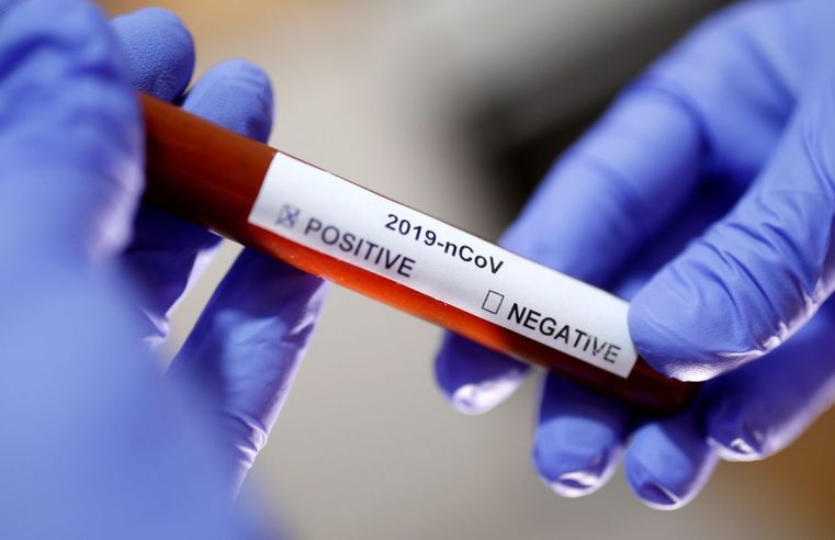 Disseminação de fake news sobre  coronavírus preocupa especialistas