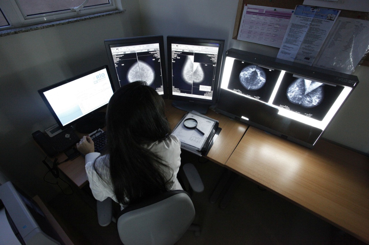 Rio Imagem oferece mamografia gratuita em todo o mês de outubro