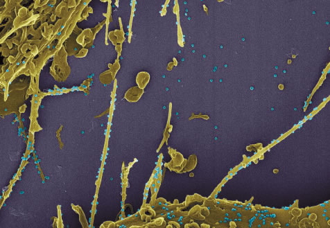 Imagens obtidas pela Fiocruz e  Inmetro mostram coronavírus em ação